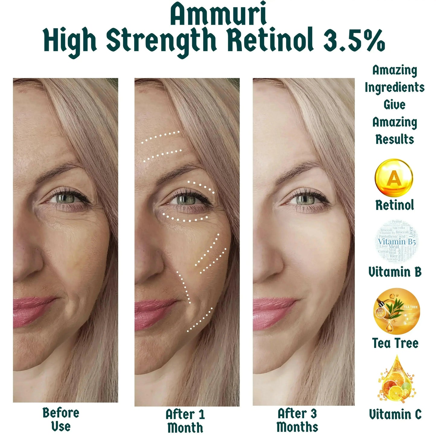 Ammuri Skincare Anti Aging Face Serum - High Volume Retinol 3.5%