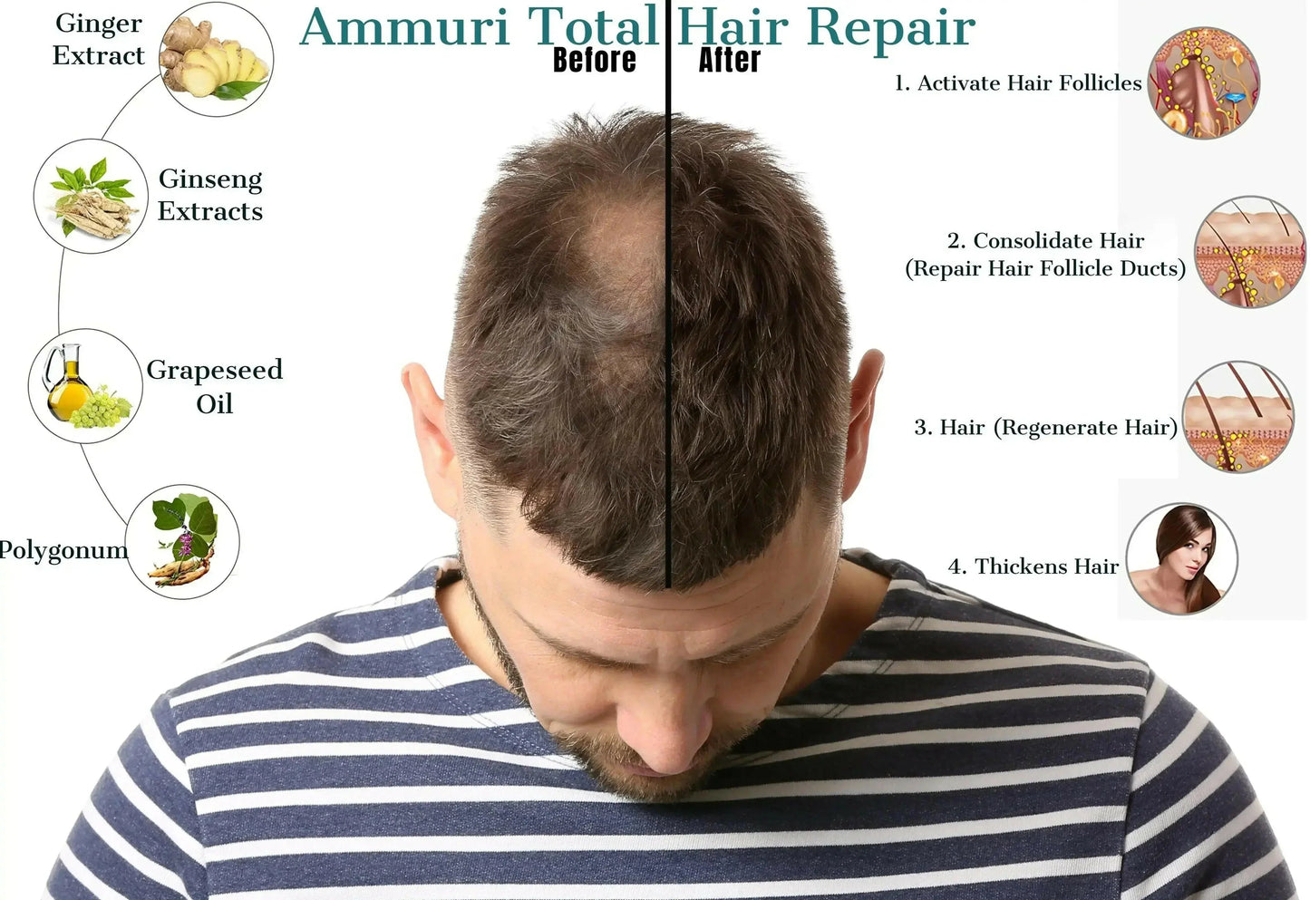 Ammuri Natural Hair Oil – Nourishing Scalp & Hair Care for Thicker-Looking Hair (50ml)